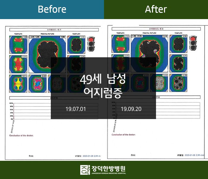 수술후기 이미지