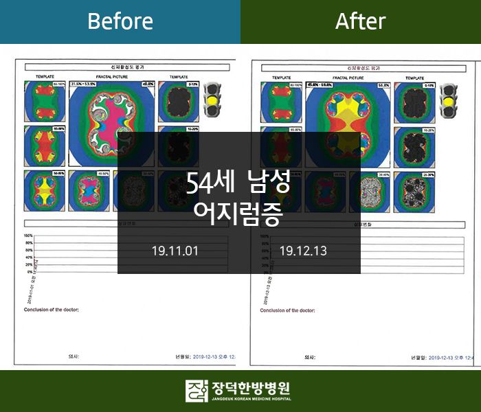 수술후기 이미지